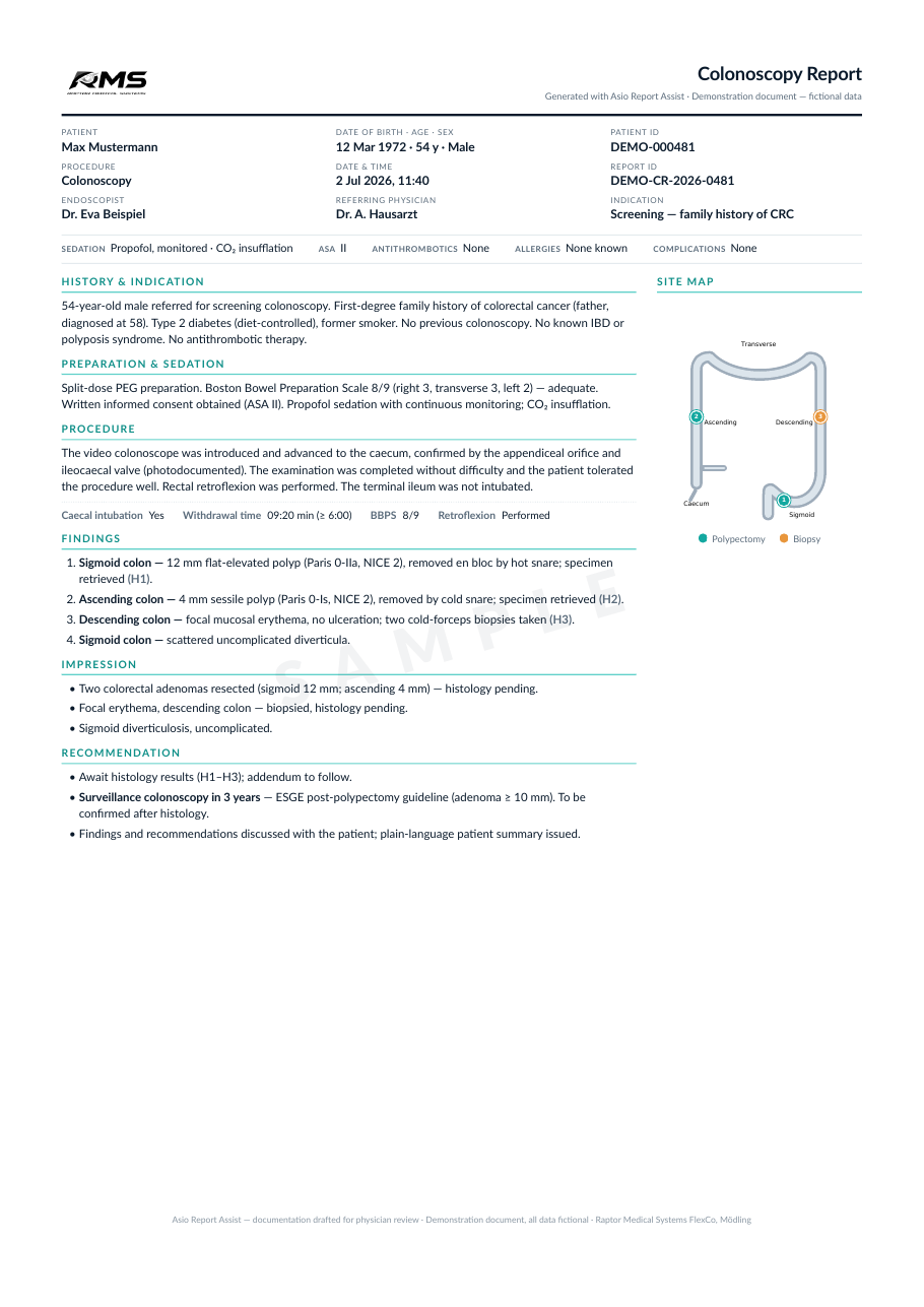 Sample colonoscopy report, page 1 — history, procedure, findings, impression and recommendation with colon site map
