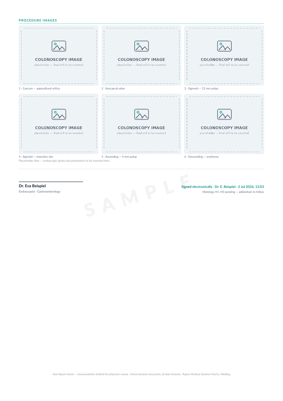 Sample colonoscopy report, page 2 — procedure image documentation and sign-off